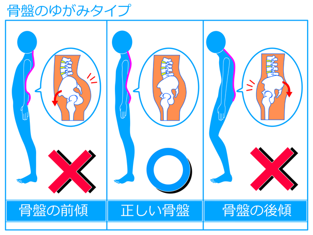 元気整骨鍼灸院のパーフェクト骨盤矯正あなたの体はここで変わります！！