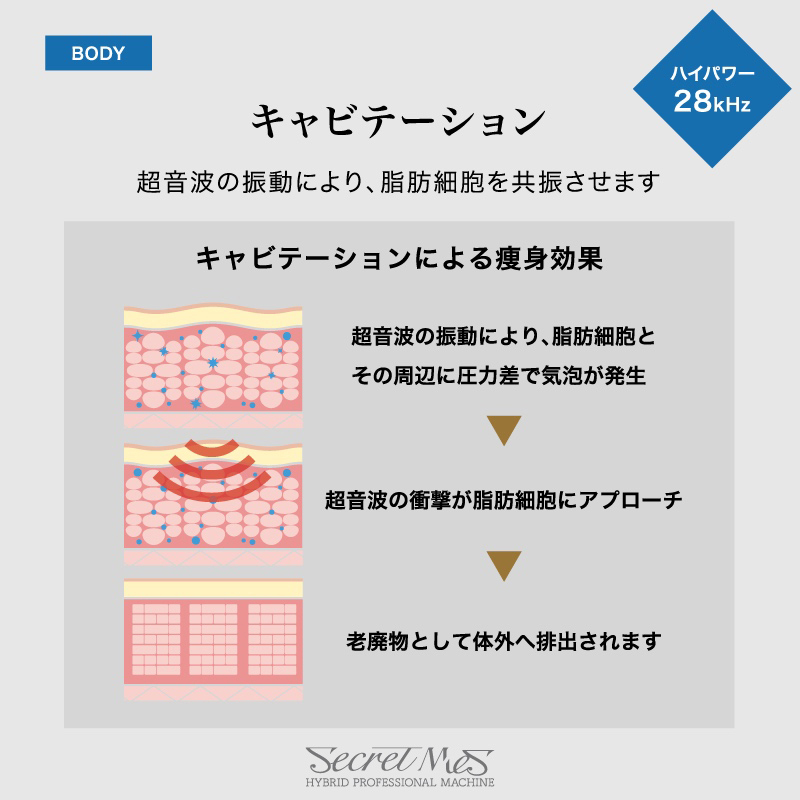 ☆キャビテーション × ラジオ波